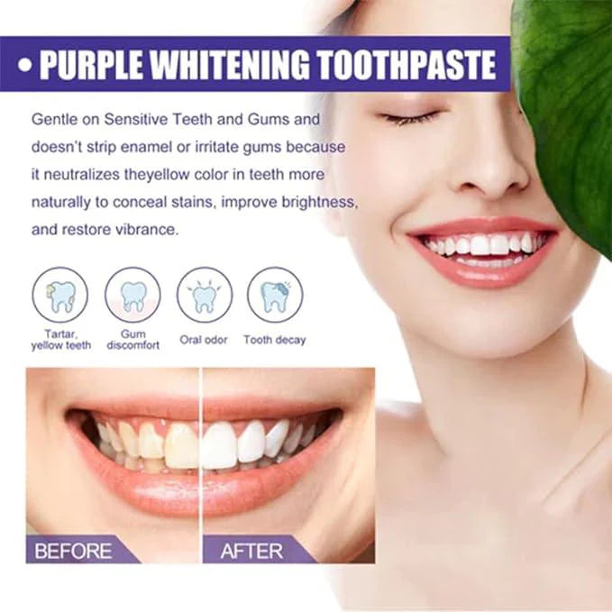 Purple Teeth Whitening Toothpaste – Instant Stain Removal & Bright Smile | معجون أسنان أرجواني لتبييض فوري وإزالة التصبغات