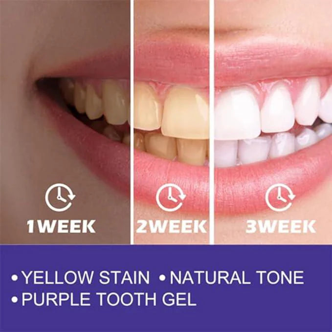 Purple Teeth Whitening Toothpaste – Instant Stain Removal & Bright Smile | معجون أسنان أرجواني لتبييض فوري وإزالة التصبغات